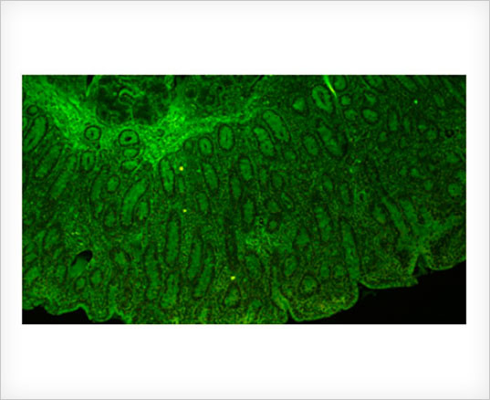 Rapid capture of low light images