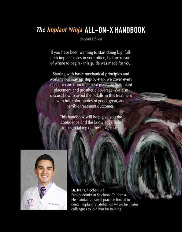 All on X Handbook - (Hardcopy only) - Implant Ninja