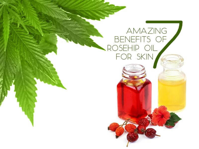 7 Amazing Benefits of Rosehip Oil for Skin 7 Amazing Benefits of Rosehip Oil for Skin