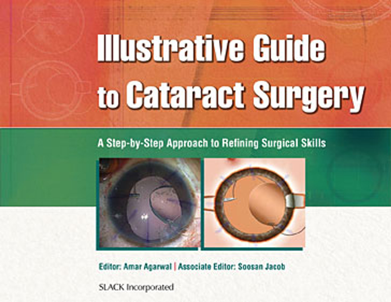 West Coast Retina Case of the Month Oct, 2022