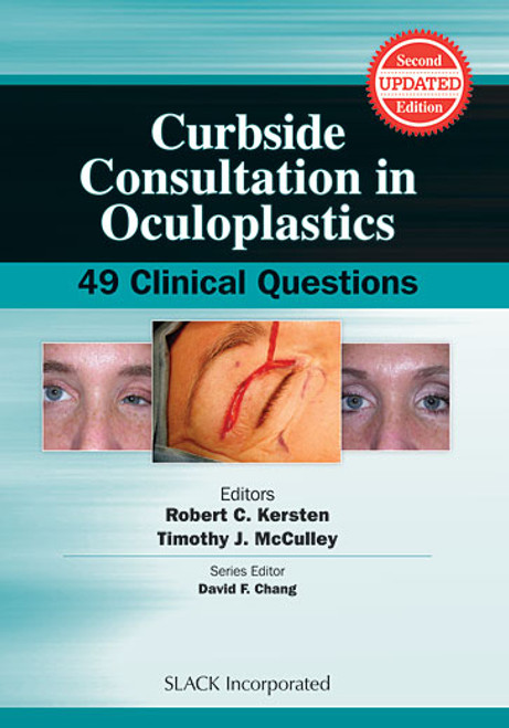 Turquoise cover of Curbside Consultation in Oculoplastics: 49 Clinical Questions, Second Edition with eye images