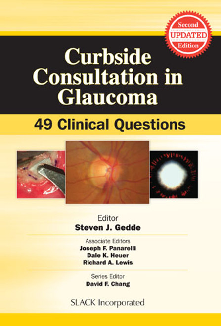 Curbside Consultation in Glaucoma: 49 Clinical Questions, Second Edition