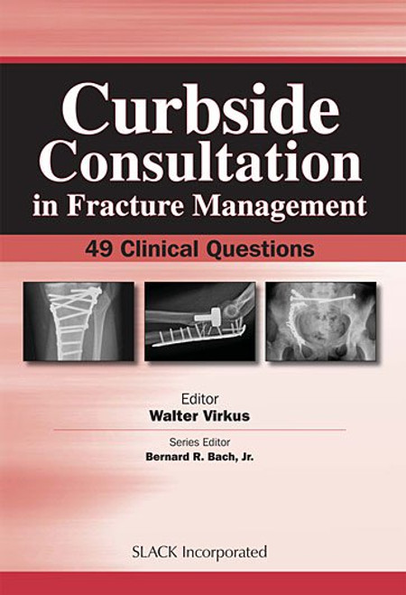 Red cover for Curbside Consultation in Fracture Management with three surgical images