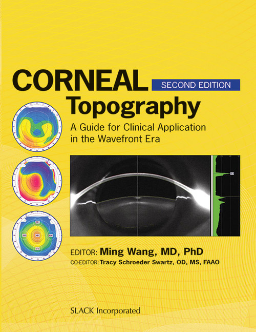 Corneal Topography: A Guide for Clinical Application in Wavefront Era, Second Edition