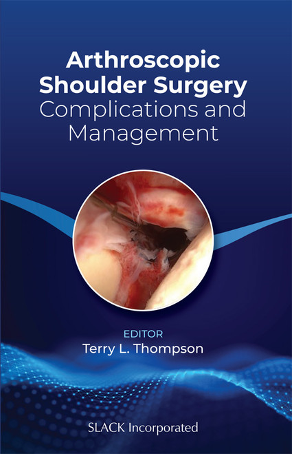 Arthroscopic Shoulder Surgery: Complications and Management Arthroscopic Shoulder Surgery: Complications and Management