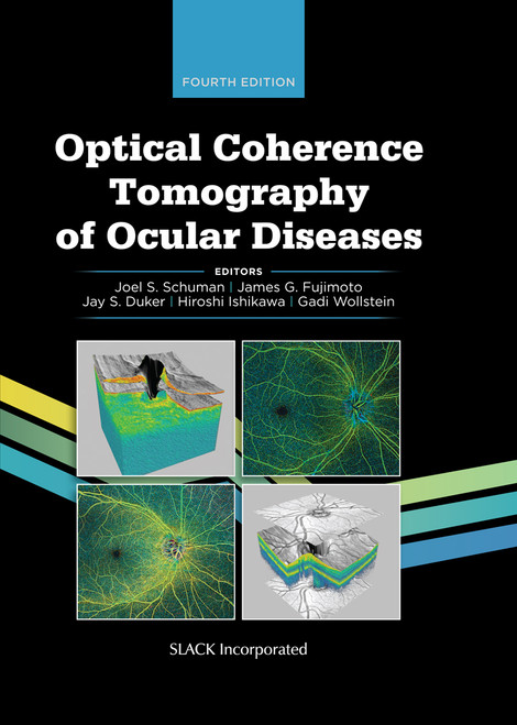 Black cover with OCT imagery for Optical Coherence Tomography of Ocular Diseases, Fourth Edition Black cover with OCT imagery for Optical Coherence Tomography of Ocular Diseases, Fourth Edition