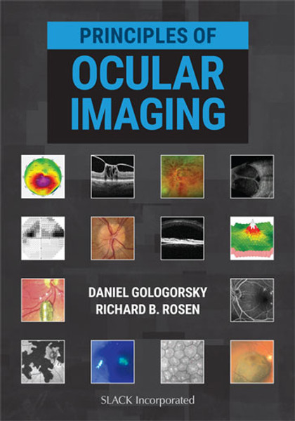 Black and blue cover with ocular imaging pictures for Principles of Ocular Imaging