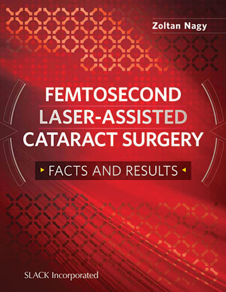 All-text red cover for Femtosecond Laser-Assisted Cataract Surgery: Facts and Results