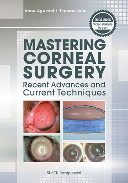 Silver cover with eye imagery for Mastering Corneal Surgery: Recent Advances and Current Techniques