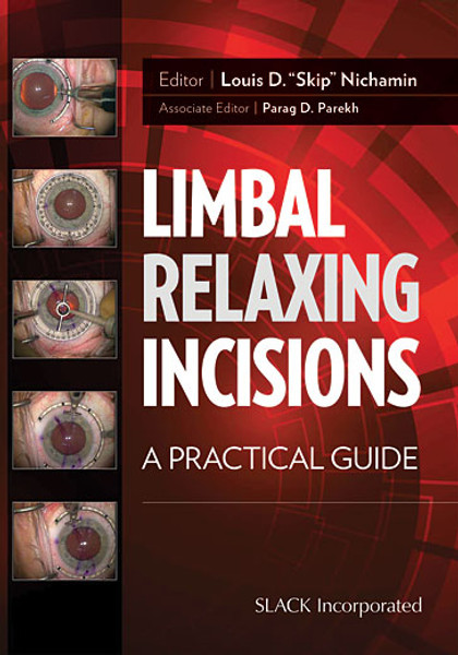 Red cover with eye images for Limbal Relaxing Incisions: A Practical Guide