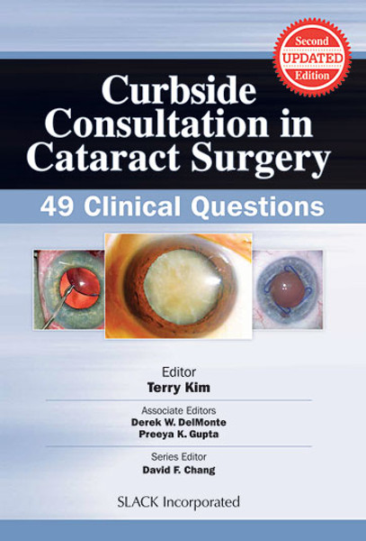 Light blue cover with eye images for Curbside Consultation in Cataract Surgery: 49 Clinical Questions, Second Edition