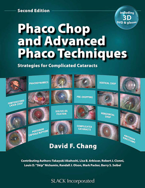 Teal cover with eye image mosaic for Phaco Chop and Advanced Phaco Techniques: Strategies for Complicated Cataracts, Second Edition