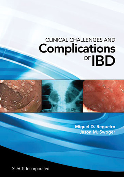 Blue and white Clinical Challenges and Complications of IBD cover with GI images