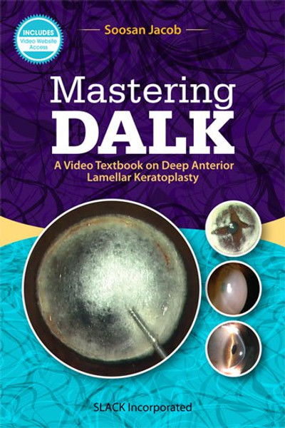 Purple and blue cover with eye images for Mastering DALK: A Video Textbook on Deep Anterior Lamellar Keratoplasty