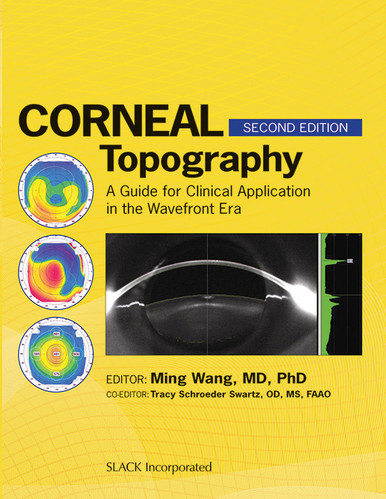 Corneal Topography: A Guide for Clinical Application in Wavefront