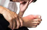 Uric Acid, Hypertension and Gout