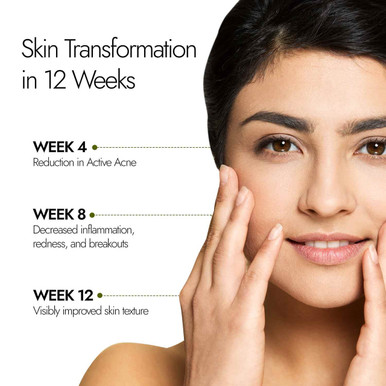 Kapiva Acne Ease Fizz