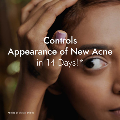Tulsi Anti Acne Serum - For Active Acne & Acne Marks