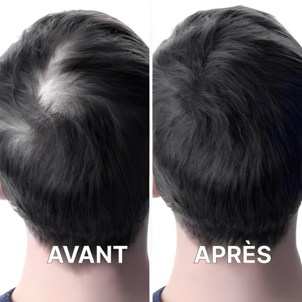 Casque Pour La Repousse Des Cheveux Casque Pour La Repousse Des Cheveux zaxx