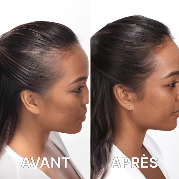 Casque Pour La Repousse Des Cheveux Casque Pour La Repousse Des Cheveux zaxx