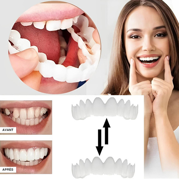 Facettes Dentaires Clipsables Facettes Dentaires Clipsables zaxx