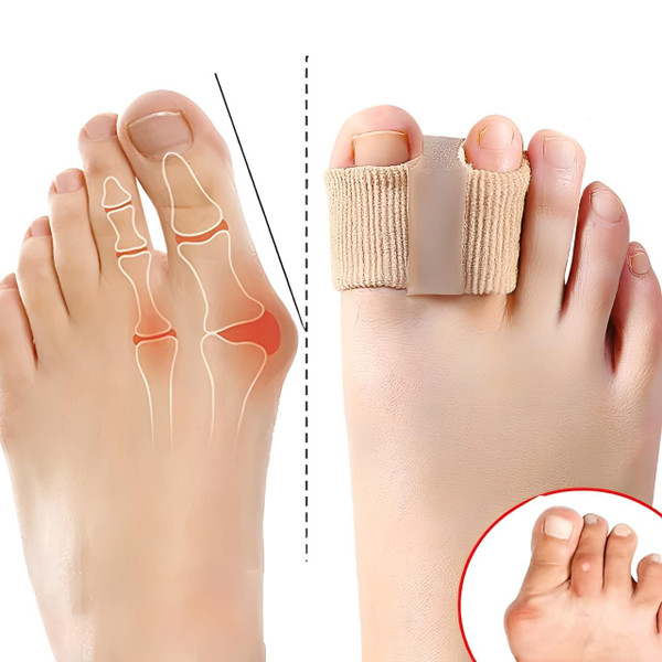 Séparateur d'Orteils Correcteur Hallux Valgus (lot de 2) Séparateur d'Orteils Correcteur Hallux Valgus (lot de 2) zaxx