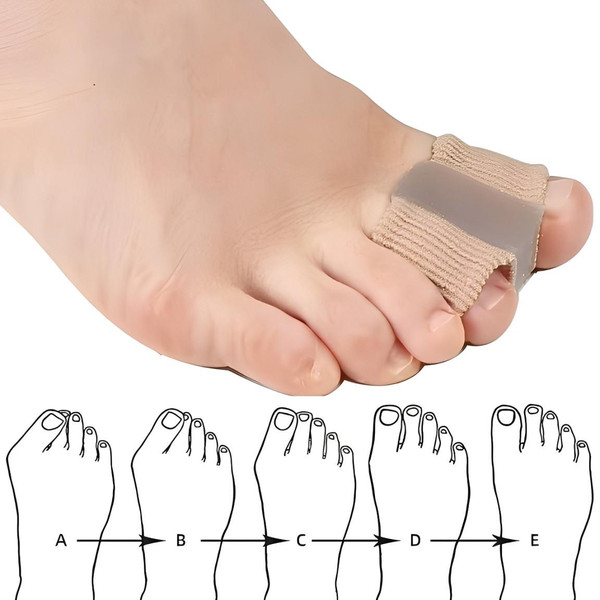 Séparateur d'Orteils Correcteur Hallux Valgus (lot de 2) Séparateur d'Orteils Correcteur Hallux Valgus (lot de 2) zaxx
