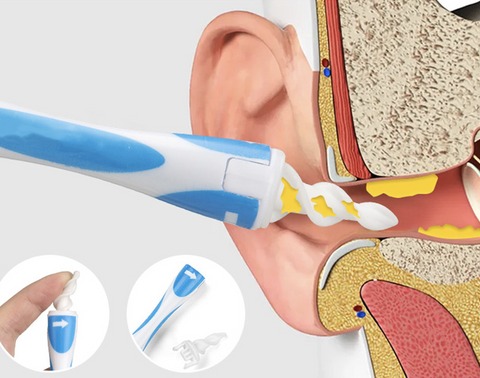 Outil De Suppression De Cérumen Pour Les Oreilles Avec Nettoyeur D'oreille  À Spirale Électrique Et Tampon De Retrait De Cérumen, Mode en ligne