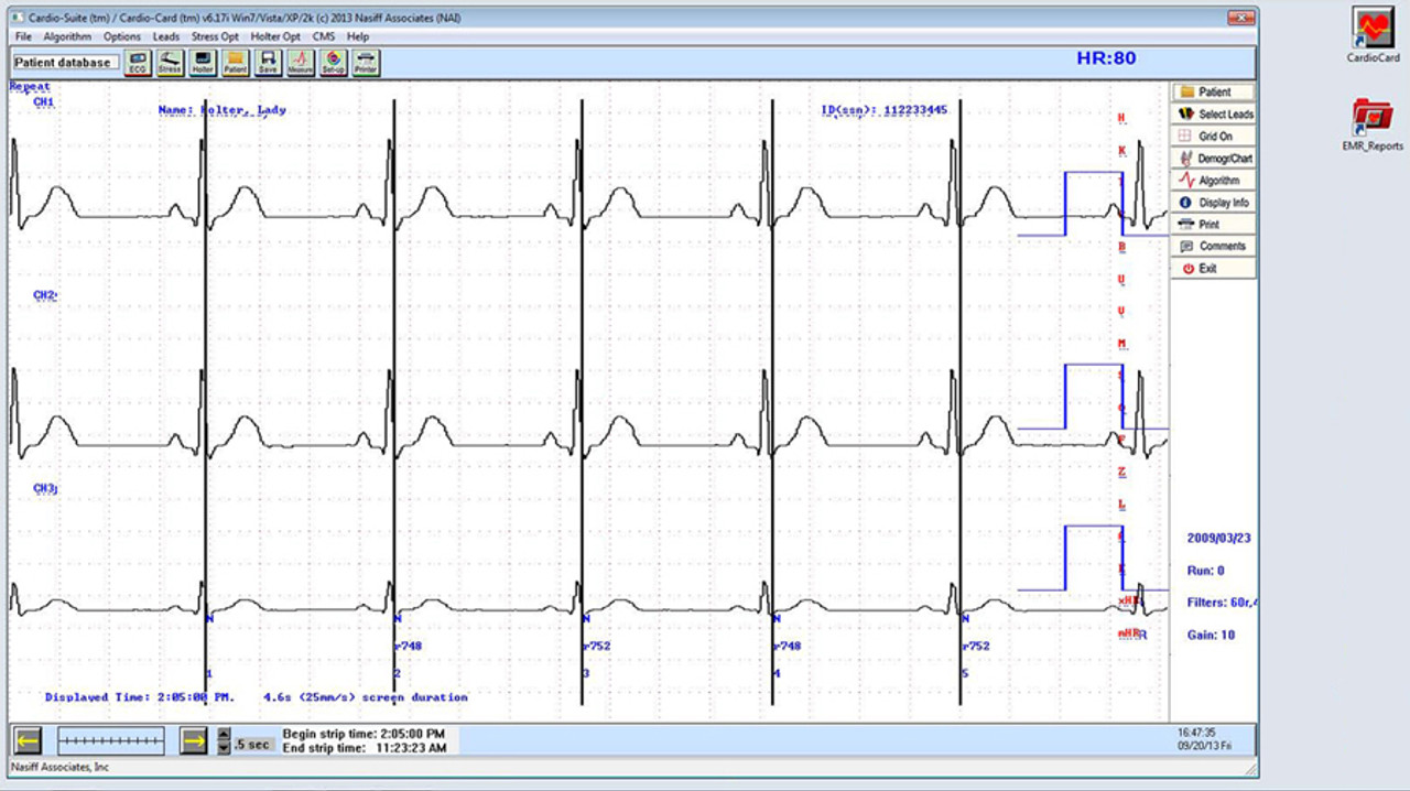 PC Based Holter ECG System - CC-HOLTER