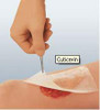 Impregnated Dressing Cuticerin 20 X 40 cm Gauze Cuticerin Ointment Sterile 66045502