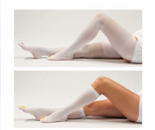 Anti-embolism Stockings Thigh-high X-Large Beige Closed Toe 11110XL-SHORT Pair/1