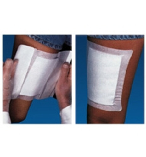 Adhesive Dressing WoundGard 6 X 6 Inch Gauze Square White NonSterile MP00098 Each/1