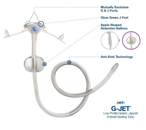 Balloon Skin Level Balloon Gastrostomy Kit Kangaroo 12 Fr. 1.7 cm Silicone 712170 CT/1