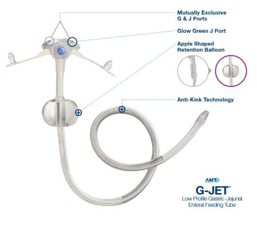 Low Profile Gastric-Jejunal Enteral Feeding Tube G-JET 14 Fr. 3.0 / 45 cm Silicone GJ-1430-45 Each/1