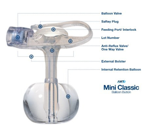 Balloon Button Gastrostomy Feeding Device AMT MINI Classic 14 Fr. 5 cm Tube Silicone Sterile 5-1450 Each/1