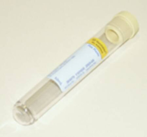 BD Vacutainer Urinalysis Tube Round Bottom Plain 16 X 100 mm 10 mL Yellow Conventional Closure Plastic Tube 364979