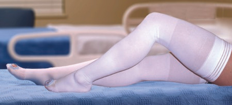 Anti-embolism Stocking McKesson Thigh High X-Large / Regular White Inspection Toe 84-44