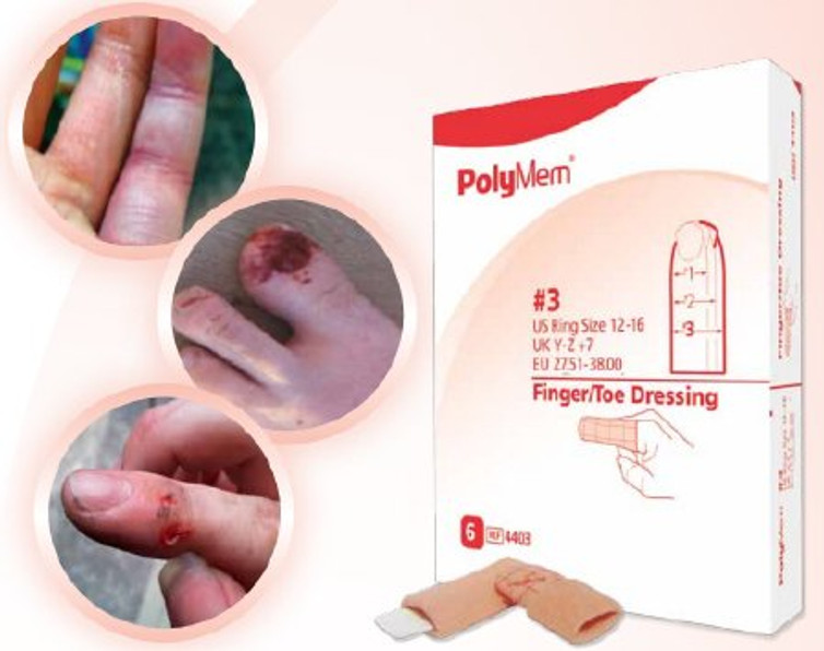 Foam Dressing PolyMem 2.2 to 2.6 Inch Circumference Finger / Toe Non-Adhesive without Border NonSterile 4402
