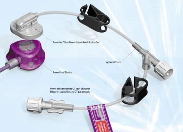 Huber Infusion Set PowerLoc Max 20 Gauge 3/4 Inch 8 Inch Tubing Y-Site Injection Port 0132075 Case/25