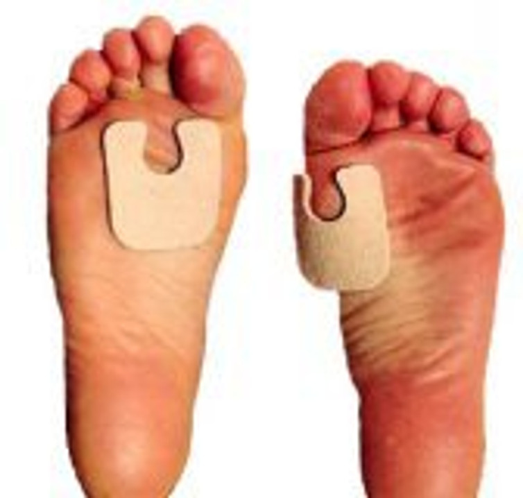 Metatarsal Pad Dr. Jill s Adhesive Foot J-10 FELT 1/4 Bag/100