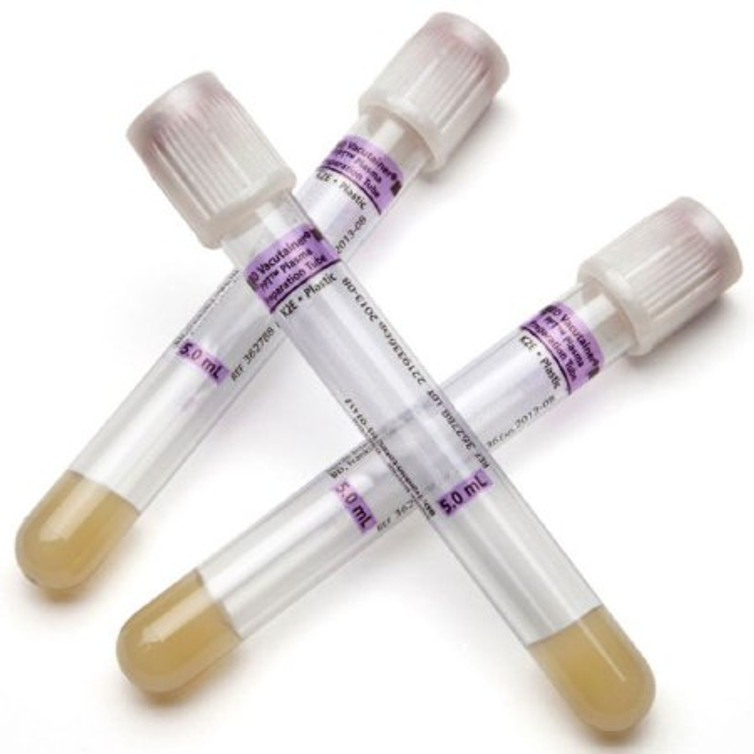 BD Vacutainer PPT Venous Blood Collection Tube Plasma Tube K2 EDTA / Separator Gel Additive 13 X 100 mm 5 mL Pearlesent White BD Hemogard Closure Plastic Tube 362788