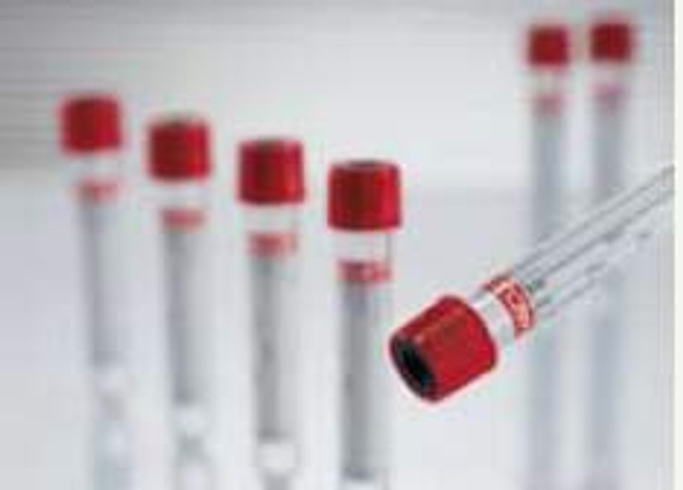 VACUETTE Z Serum Clot Activator Venous Blood Collection Tube Serum Tube Clot Activator Additive 16 X 100 mm 9 mL Red / Black Ring Pull Cap Polyethylene Terephthalate PET Tube 455092