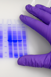 Demystifying Diagnostics: A Guide to Stains and Reagents for Better Patient Care