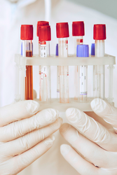 The Lifeblood of the Lab: A Complete Guide to Laboratory Consumables