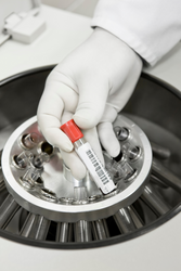 Questions to Ask When Purchasing a Centrifuge