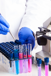 Choosing Wisely: Essential Factors to Consider When Buying Laboratory Consumables