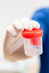 Minimizing Mistakes: Essential Strategies for Reducing Specimen Mislabeling in the Laboratory