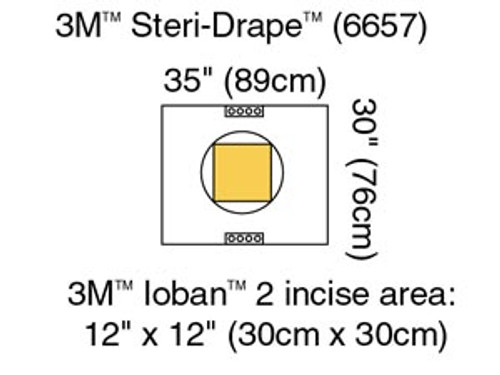 3m steri drape cesarean section sheets  pouches 10114187