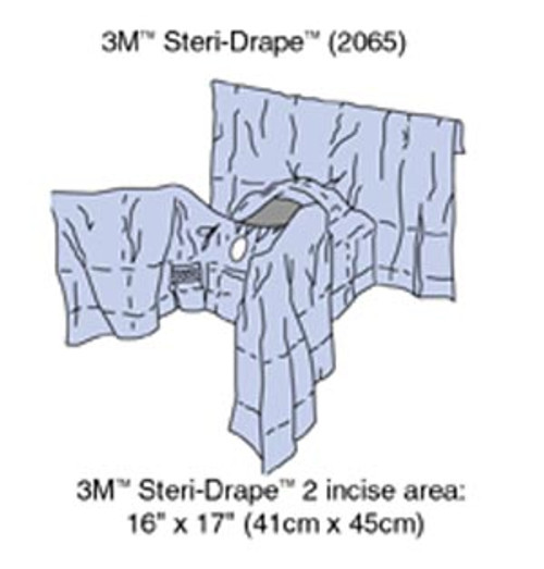 3m general surgery drapes 10143502