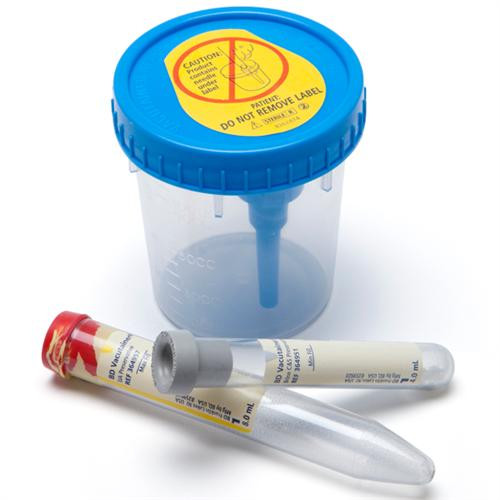 urine collection cup with integrated transfer device